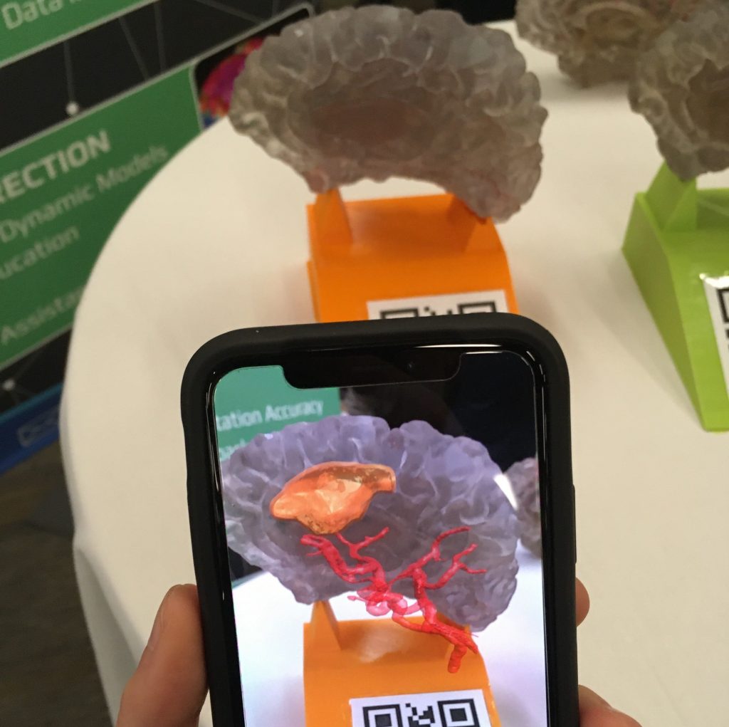AR Brain model app in use