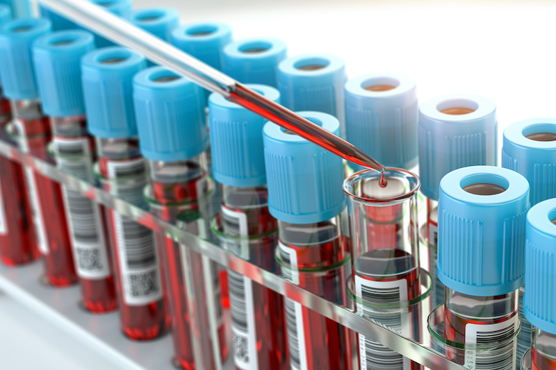 Blood test samples tubes and blood test pipette adding fluid to one of tubes in medical laboratory. 3d illustration