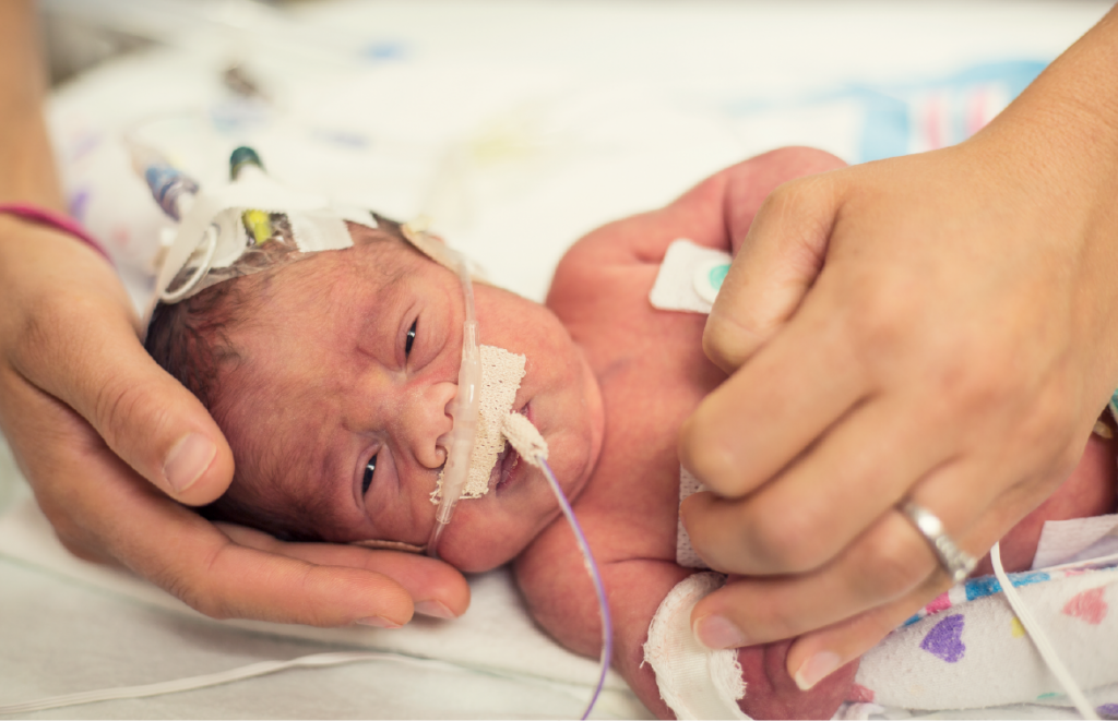 nicu baby with tubes coming out of his nose being held by a woman's hands