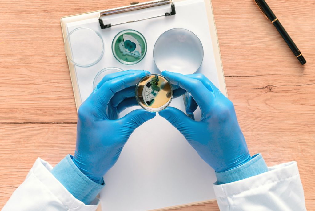 Overhead view of laboratory technician analyzing growing bacterial cultures in petri dish, science and microbiology background